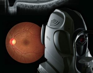 Nidek-RetinaDuo-Retinal-Camera-&-OCT-scanner